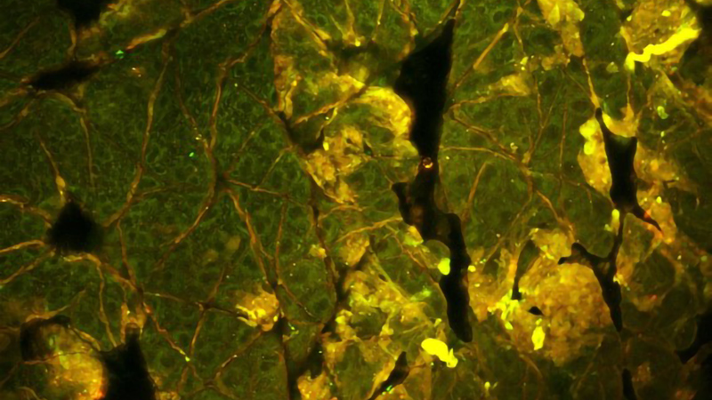 小鼠上皮的高分辨率双光子激发荧光强度图像。内源性NADH荧光为绿色，而角蛋白的自发荧光为红色/黄色。