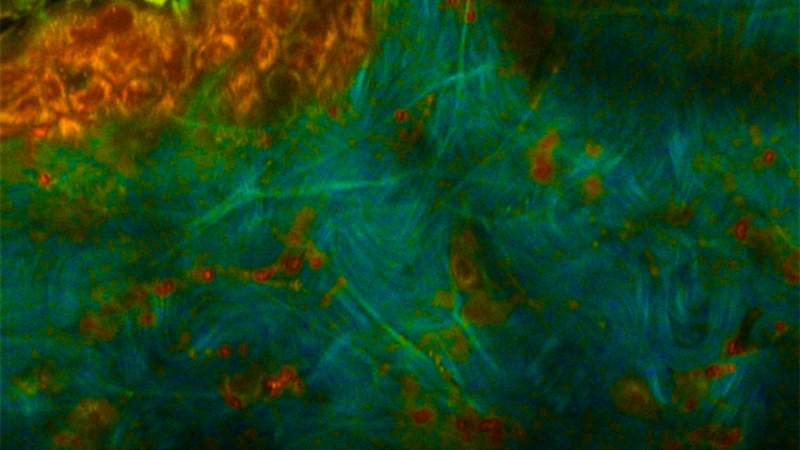 平均双光子激发荧光寿命(755nm激发;460nm发射)显示了细胞(橙色为短寿命)和细胞外基质(绿色/蓝色为长寿命)之间的对比。