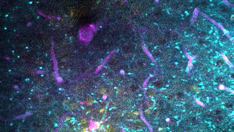 紫红色为血管，黄色为用钙染料标记的神经元细胞体。包括白质在内的纤维和过程以青色显示。