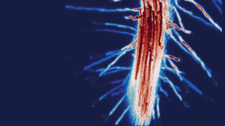 转基因拟南芥根表达膜标记——编译从纸张显微镜图像。