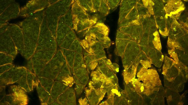 High resolution two-photon excitation fluorescence intensity image of mouse epithelium.  Intrinsic NADH fluorescence is in green, while autofluorescence from keratin is in red/yellow.