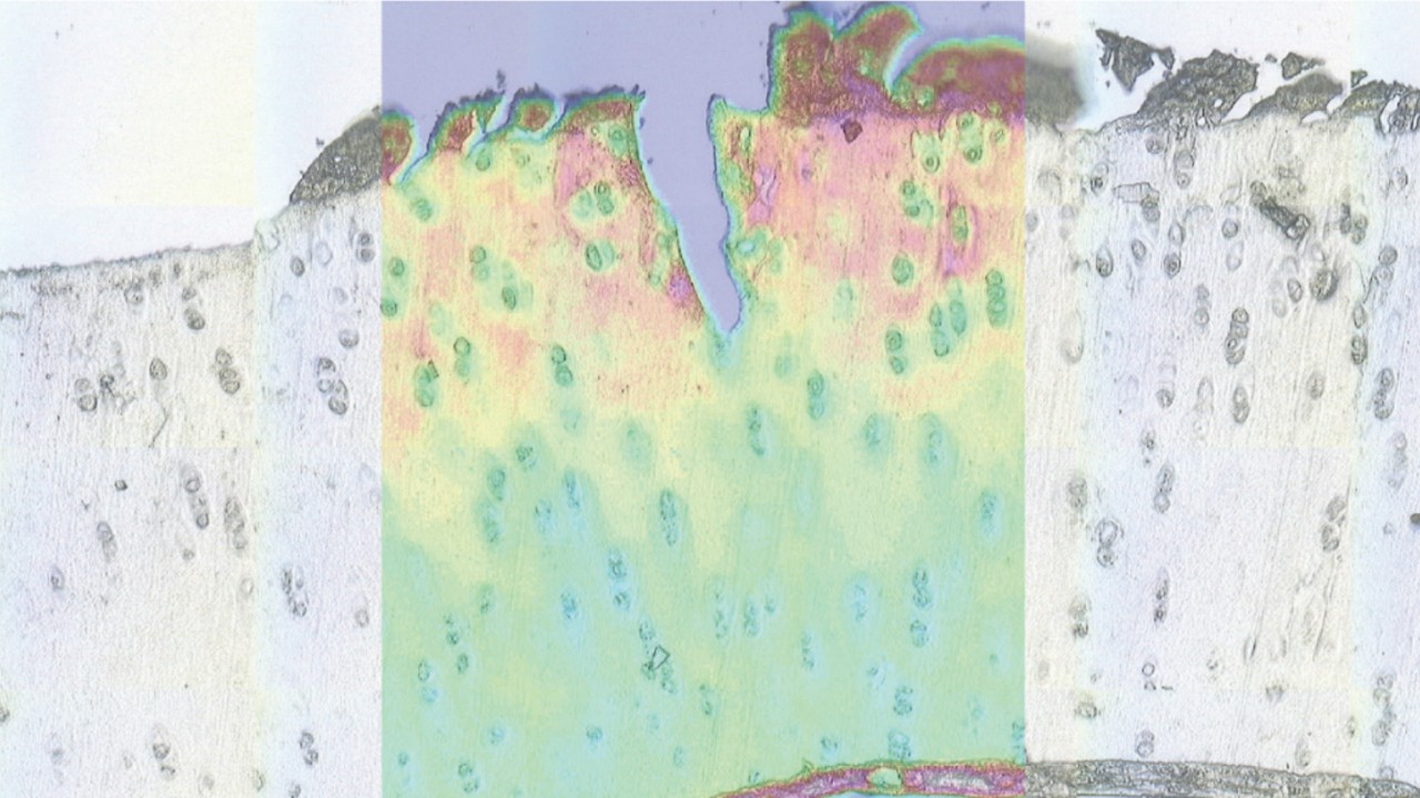 这张图片显示了组织切片的显微图像的受损的软骨。叠加的低对比度图像增强红外图像显示蛋白质,脂类和碳水化合物。
