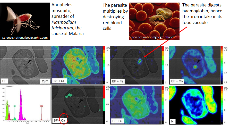 图1:树脂包埋的人血细胞感染疟原虫