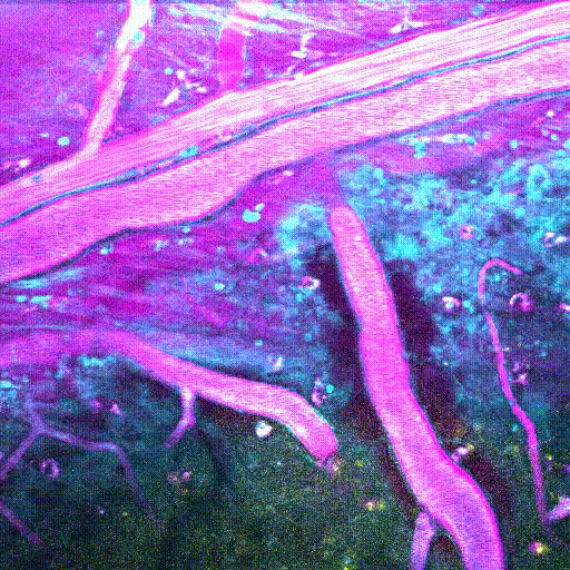 紫红色为血管，黄色为用钙染料标记的神经元细胞体。包括白质在内的纤维和过程以青色显示。