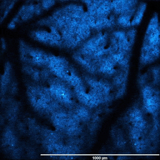 转基因小鼠中表达GCaMP6神经元的自发荧光波动