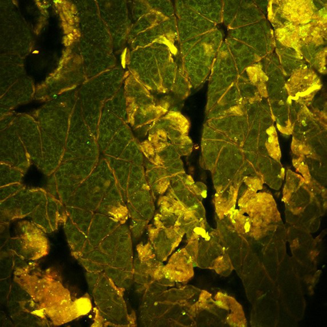 小鼠上皮的高分辨率双光子激发荧光强度图像。固有NADH荧光为绿色，而角蛋白的自身荧光为红色/黄色。