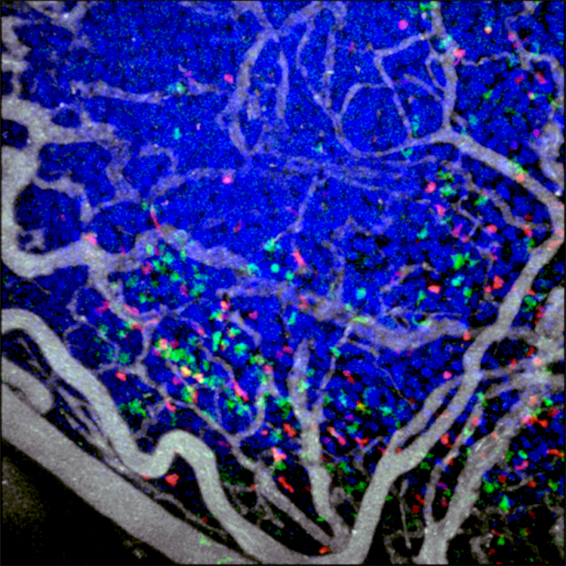 表达gfp的细胞毒性T淋巴细胞(绿色)和表达tdtomato的调节性T细胞(红色)浸润于移植到背侧皮褶腔的小鼠结肠癌。肿瘤细胞核(蓝色)通过天蓝-组蛋白H2B融合蛋白的表达进行标记。静脉注射时，血管(白色)突出显示。