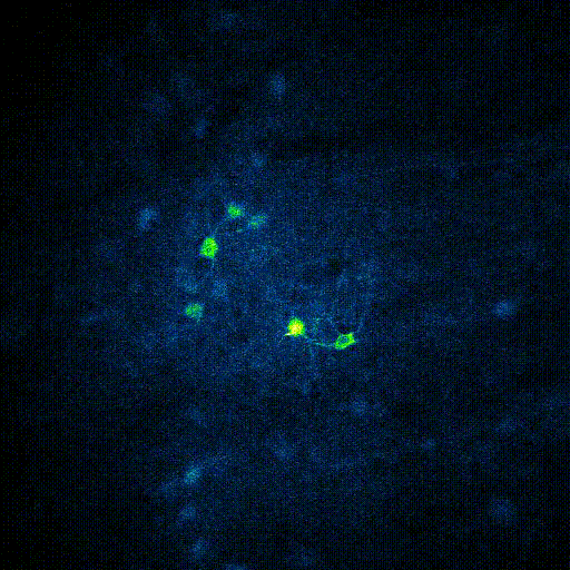 全息光刺激NeuraLight 3 d (SLM)的神经元表达GCaMP6和ChRmine在离岸金融中心通过4.2毫米grin透镜