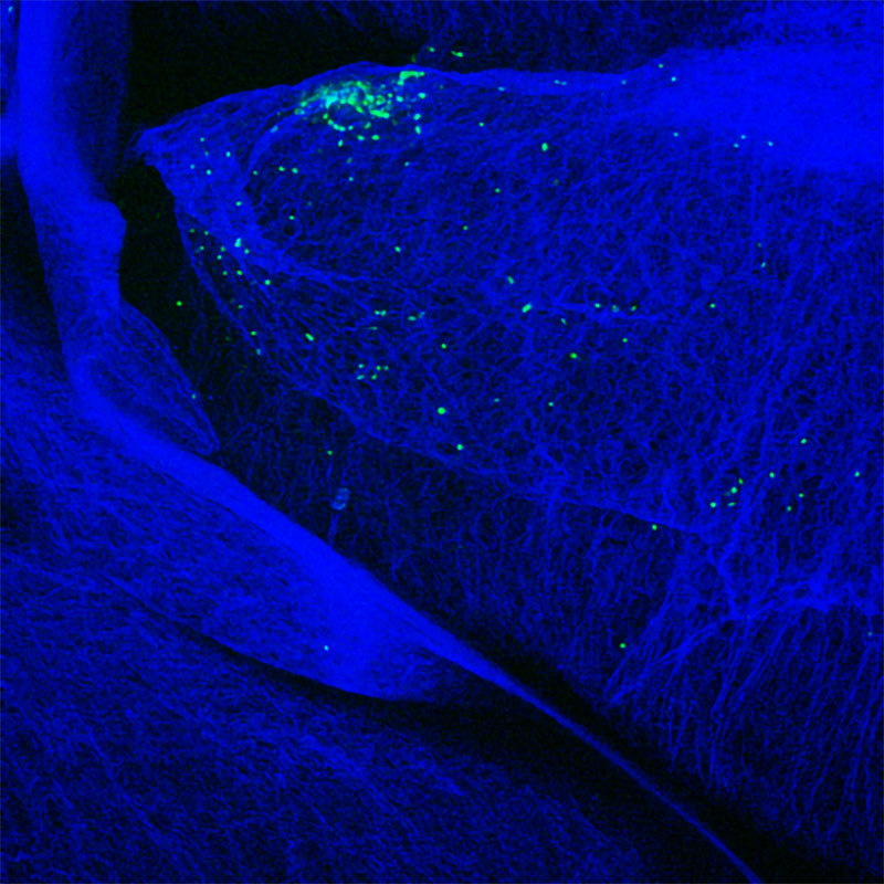 GFP-expressing T cells (green) accumulating around a pancreatic islet in a mouse developing autoimmune pancreatitis ultimately leading to diabetes.