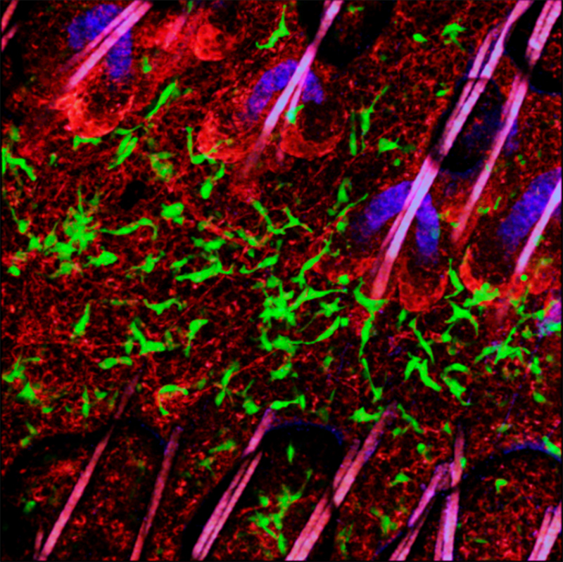 EGFP-expressing dendritic epidermal T cells (green) in the skin of a mouse. Intravenously injected Rhodamin 6G demarcates the dermal-epidermal border (red). Hair shafts (purple) are rooted in hair follicles revealed by their sebaceous glands (blue autofluorescence).