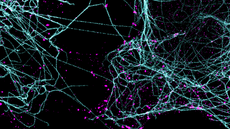 多色多路超分辨率成像静态图像。微管蛋白-聚合成长链-用青色标记。网格蛋白-组装成球形晶格-洋红色。