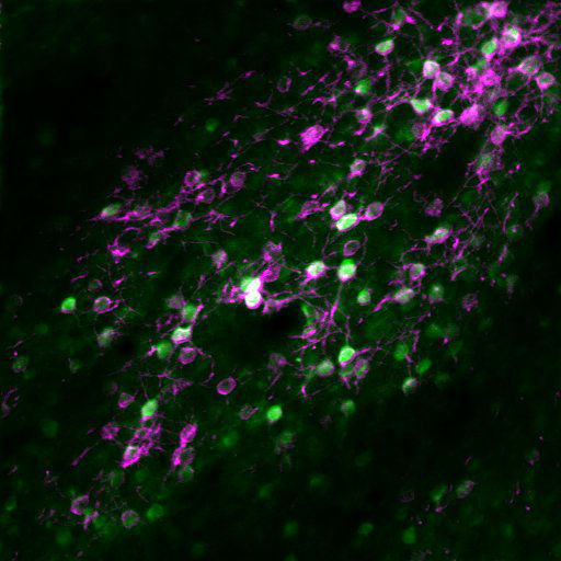 小鼠视皮层5A层神经元中GCaMP6s与soma-restricted C1V1-mRuby2的共表达