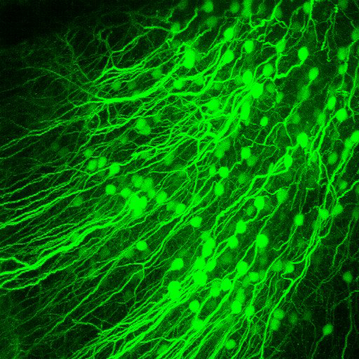 在体小鼠视皮层5B层神经元体积堆栈的3d视图，用tdTomato标记(绿色)，标尺为100µm