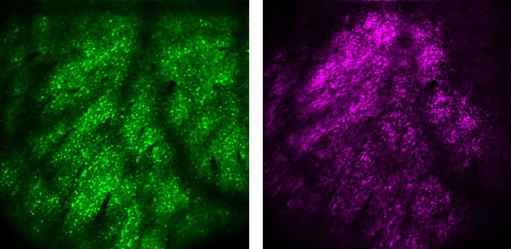 GCaMP6s(绿色)和soma-restricted C1V1-mRuby2(洋红色)在小鼠视皮层5A层神经元中在pia以下约400 μ m深度的共表达(右)